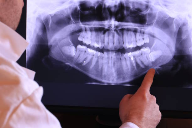 Best Tooth Pain Emergency Relief  in Lake Wildwood, CA